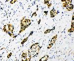 SF1 Antibody in Immunohistochemistry (Paraffin) (IHC (P))