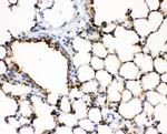 SFTPA1 Polyclonal Antibody