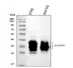 SFTPA1/SFTPA2 Antibody in Western Blot (WB)