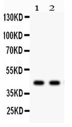 Alpha Sarcoglycan Antibody in Western Blot (WB)