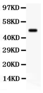 SGK1 Polyclonal Antibody