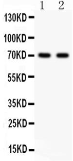 SHBG Polyclonal Antibody