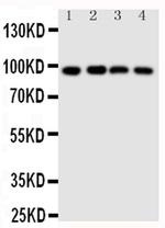 SIDT1 Antibody in Western Blot (WB)
