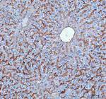 NTCP Polyclonal Antibody