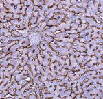 NTCP Polyclonal Antibody