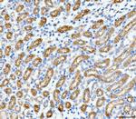 SLC12A1 Antibody in Immunohistochemistry (Paraffin) (IHC (P))
