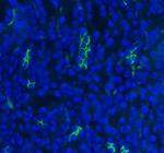 SLC12A1 Polyclonal Antibody