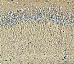 GLT-1 Antibody in Immunohistochemistry (Paraffin) (IHC (P))