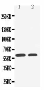 SLC22A1 Polyclonal Antibody