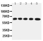 SLC22A5 Polyclonal Antibody