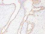 SLC22A6 Polyclonal Antibody