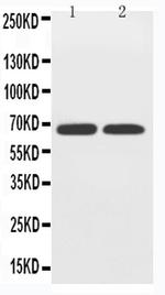 SLC2A12 Polyclonal Antibody