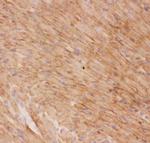 GLUT4 Antibody in Immunohistochemistry (Frozen) (IHC (F))
