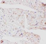 GLUT4 Antibody in Immunohistochemistry (Paraffin) (IHC (P))