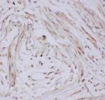 GLUT4 Polyclonal Antibody