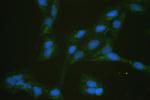 GLUT5 Polyclonal Antibody