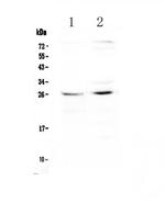 CTR1 Polyclonal Antibody