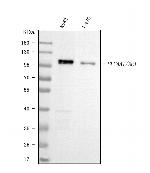 Band 3 Antibody in Western Blot (WB)