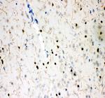 SLC6A4 Antibody in Immunohistochemistry (Paraffin) (IHC (P))