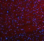 SLC6A4 Polyclonal Antibody