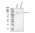 SLC6A4 Antibody in Western Blot (WB)
