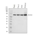 SLC6A4 Antibody in Western Blot (WB)