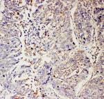 SLC9A2 Polyclonal Antibody