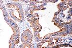 SMAD5 Polyclonal Antibody