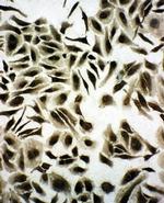 SNRPN Antibody in Immunocytochemistry (ICC/IF)