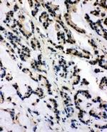 SNRPN Antibody in Immunohistochemistry (Paraffin) (IHC (P))