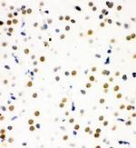 SNRPN Antibody in Immunohistochemistry (Paraffin) (IHC (P))