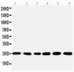 SNRPN Antibody in Western Blot (WB)