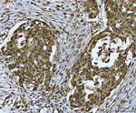 SNRPN Antibody in Immunohistochemistry (Paraffin) (IHC (P))
