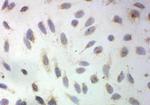 SOD3 Polyclonal Antibody