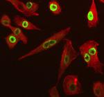 SP6 Polyclonal Antibody