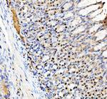 SP6 Antibody in Immunohistochemistry (Paraffin) (IHC (P))