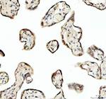 SP6 Antibody in Immunohistochemistry (Paraffin) (IHC (P))