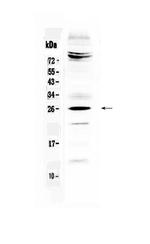 SRY Polyclonal Antibody