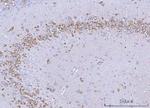SSR3 Antibody in Immunohistochemistry (Paraffin) (IHC (P))