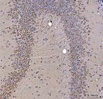 SSR3 Antibody in Immunohistochemistry (Paraffin) (IHC (P))