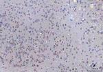 SSR3 Antibody in Immunohistochemistry (Paraffin) (IHC (P))