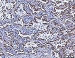 SSR3 Antibody in Immunohistochemistry (Paraffin) (IHC (P))