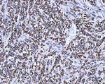 SSR3 Antibody in Immunohistochemistry (Paraffin) (IHC (P))