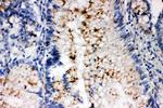 SSX2 Polyclonal Antibody