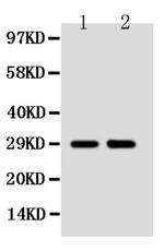 SSX2 Antibody in Western Blot (WB)