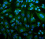 STIM1 Polyclonal Antibody