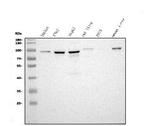 STIM1 Antibody in Western Blot (WB)