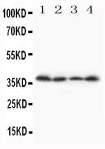 STRA8 Polyclonal Antibody