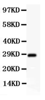 SCP3 Antibody in Western Blot (WB)