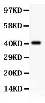 SCP3 Antibody in Western Blot (WB)